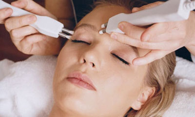 激光祛皱