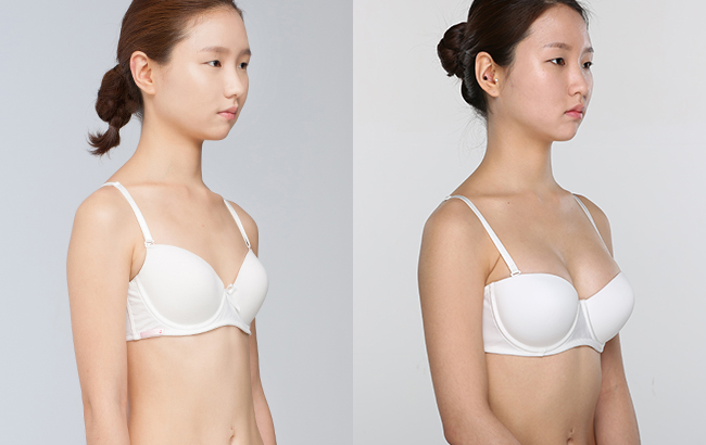 2C平面隐形丰胸 美丽就是这么牛