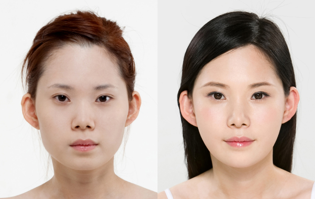 硅胶隆鼻有哪些优点