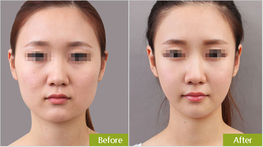 多久打快速较合适