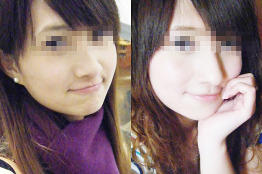 击退黑色素 美肤针给你亮白美肌