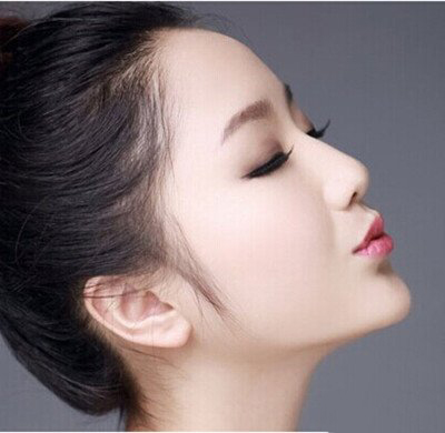 不用手术 怎样使鼻子变挺