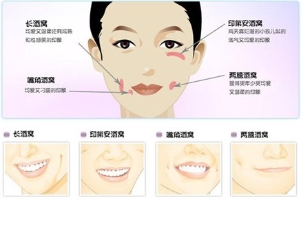 酒窝整形的自然吗？
