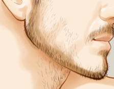 如何祛除男人的络腮胡子