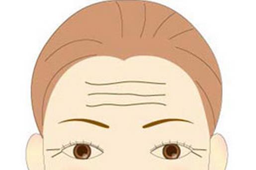 长抬头纹怎么办