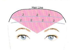 抬头皱如何消除  　　