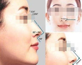 假体隆鼻疼吗,需要多长时间