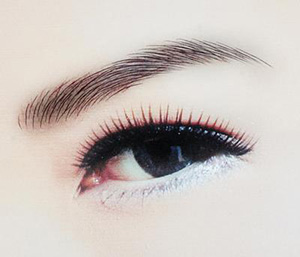 激光洗眉后天图片