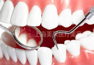 上海什么方法可以矫正牙齿缝隙大