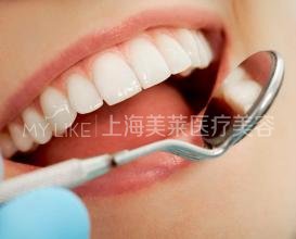 上海冷光美白牙齿术后注意的事项是什么