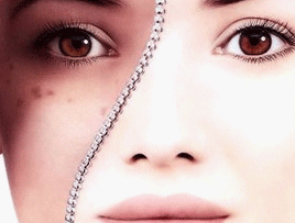 激光去老年斑的价格?