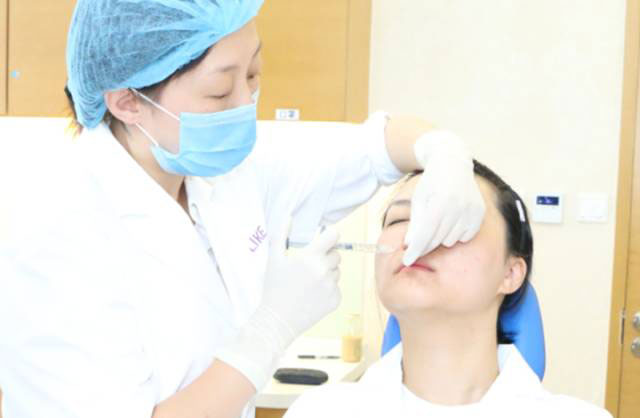 面部注射乔雅登填充鼻唇沟