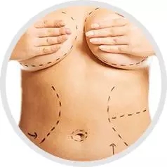 常见的丰胸方式之一