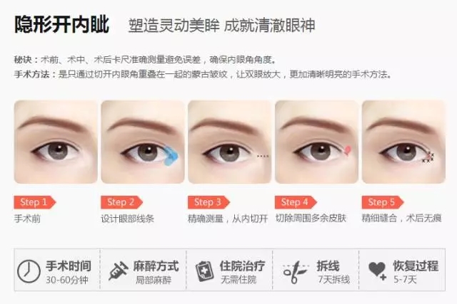 开眼角开内眦