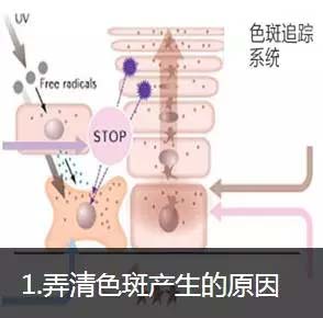 色斑产生原因