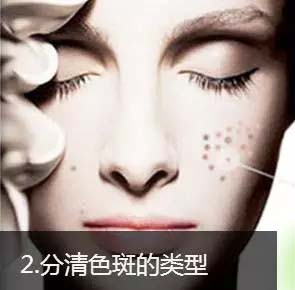 分清色斑类型
