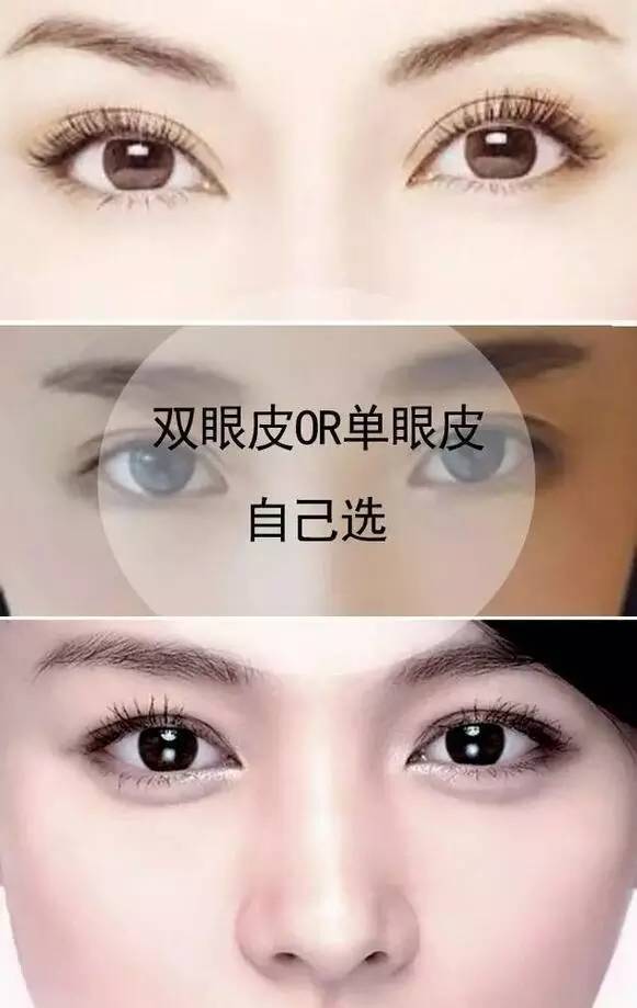 双眼皮