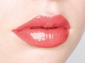 影响玻尿酸注射丰唇价格的因素是什么