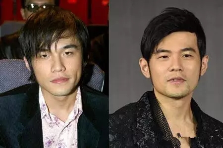 为什么会掉头发?