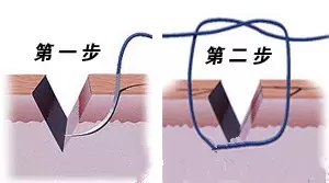 为什么会掉头发?