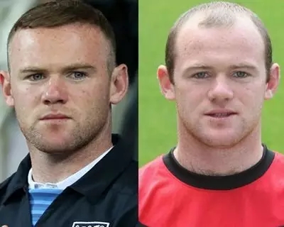 为什么会掉头发?