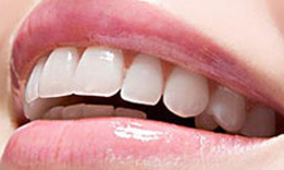 上海冷光牙齿美白注意点有哪些?