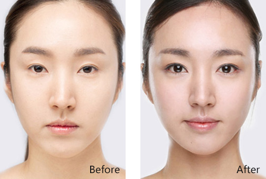 开外眼角和内眼角有何区别