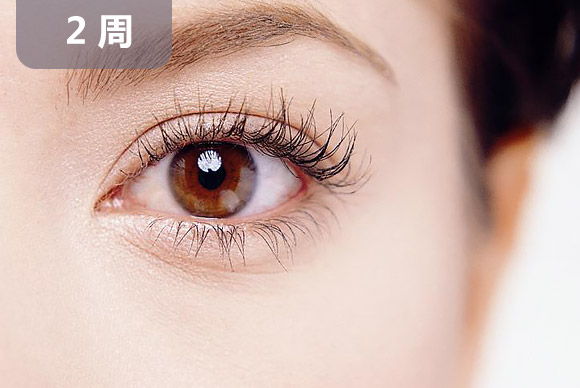 上海美莱双眼皮修复