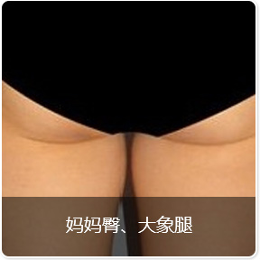大象腿