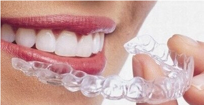 上海无托槽隐形矫正有副作用吗