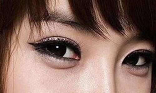 天生的黑眼圈怎么样才能祛除