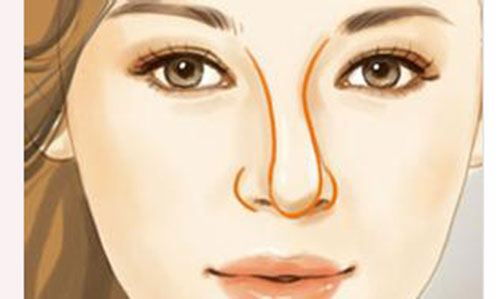 假体隆鼻手术会有危害吗