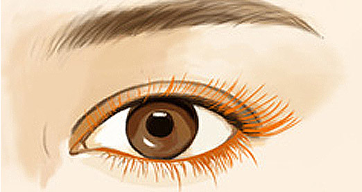 嫁接睫毛后遗症