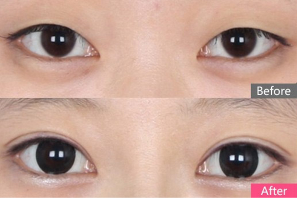 美莱颜值鉴定团,为您量身打造高颜值