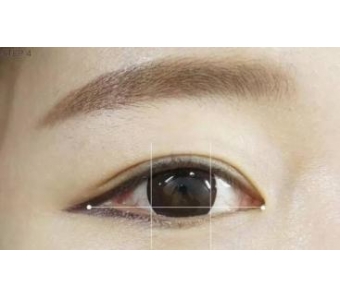上海双眼皮修复价格是多少钱