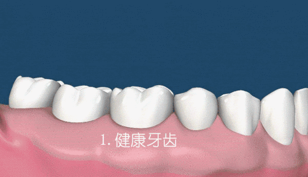 牙龈红肿
