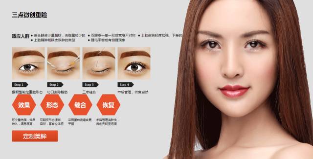 部分切开双眼皮