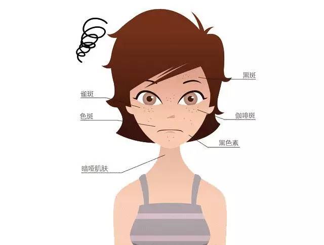 祛斑