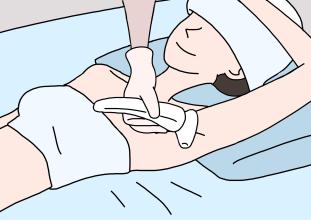 美莱激光腋下脱毛