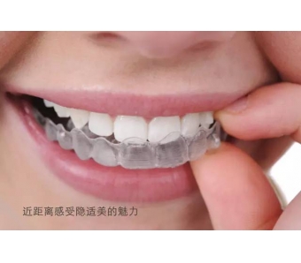 上海为什么矫正牙齿那么贵