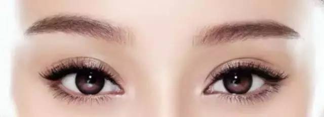 上海开眼角多长时间恢复