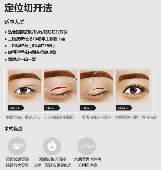 上海哪家双眼皮好