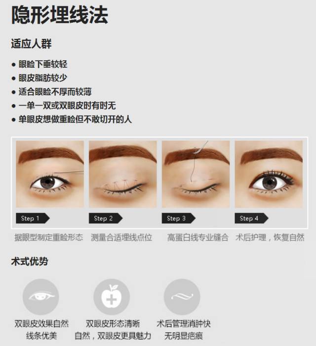 上海哪家双眼皮好