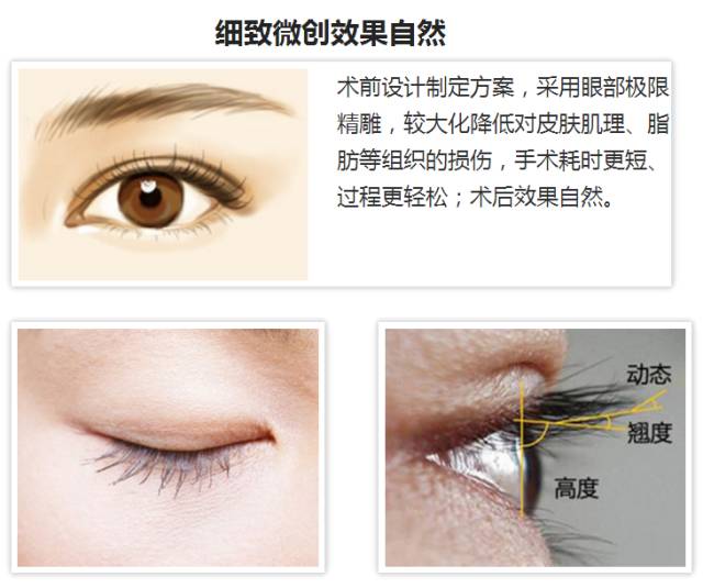 上海哪家双眼皮好