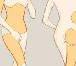 上海自体脂肪填充哪里好