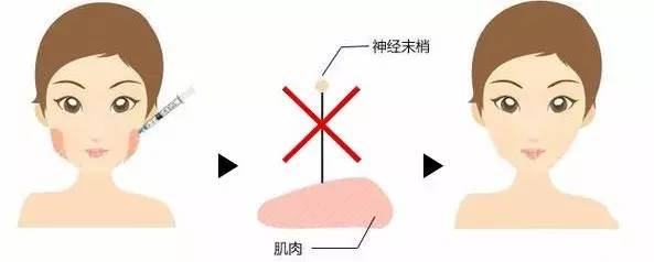 上海注射的好不好