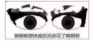 上海美莱杜医生推荐韩式高分子埋线双眼皮