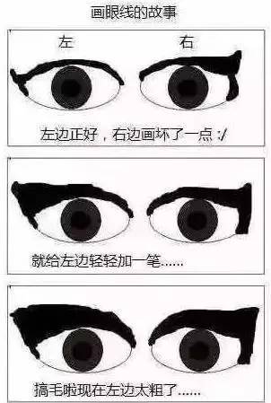 上海美莱杜医生推荐韩式高分子埋线双眼皮