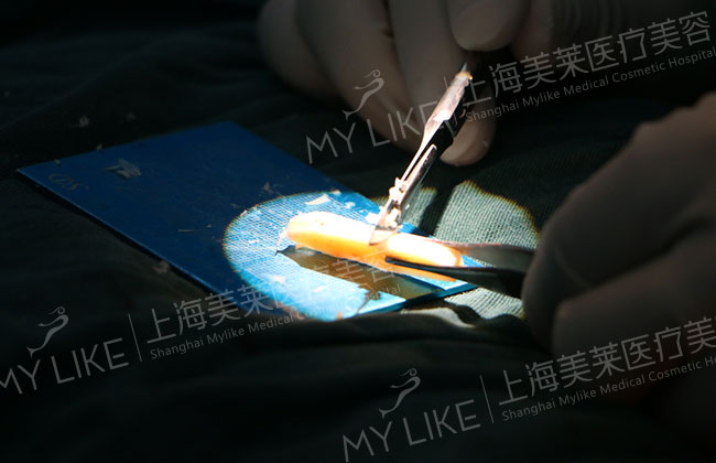 2017上海美莱ArtLine艺塑鼻雕新技术全球发布