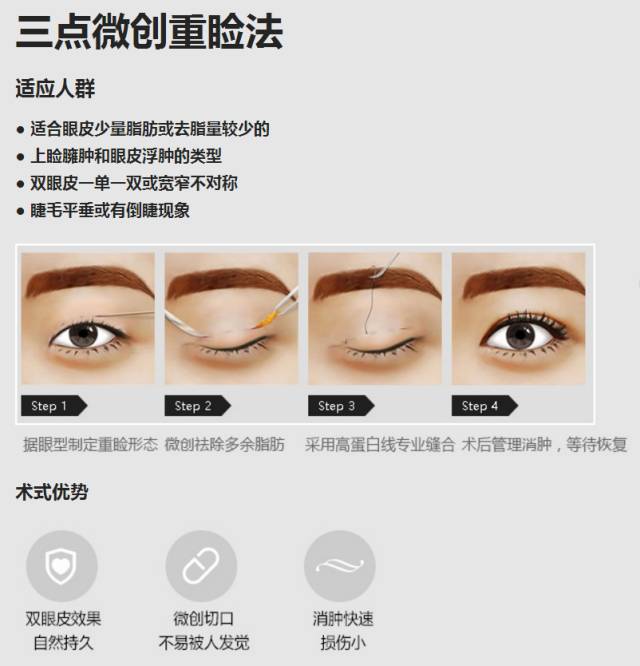 上海双眼皮整形哪家医院好